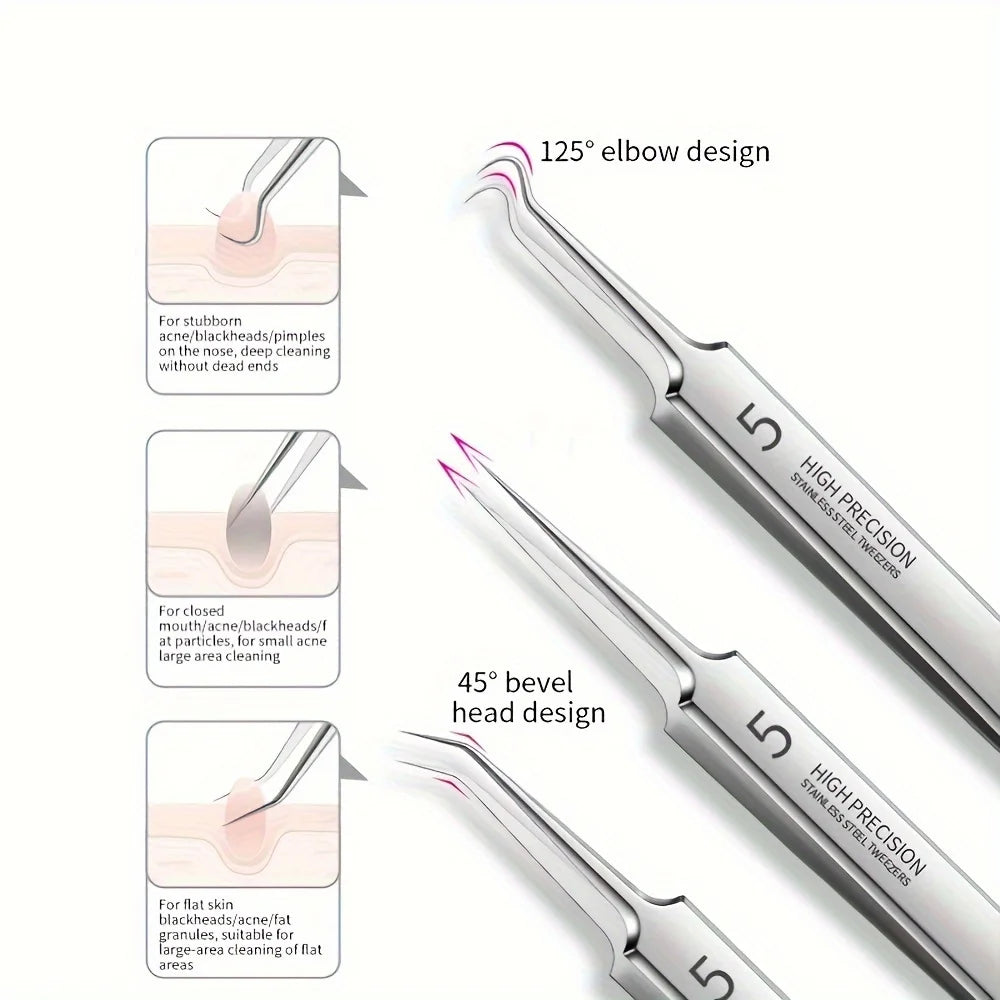 8-Piece Stainless Steel Blackhead & Pimple Removal Kit