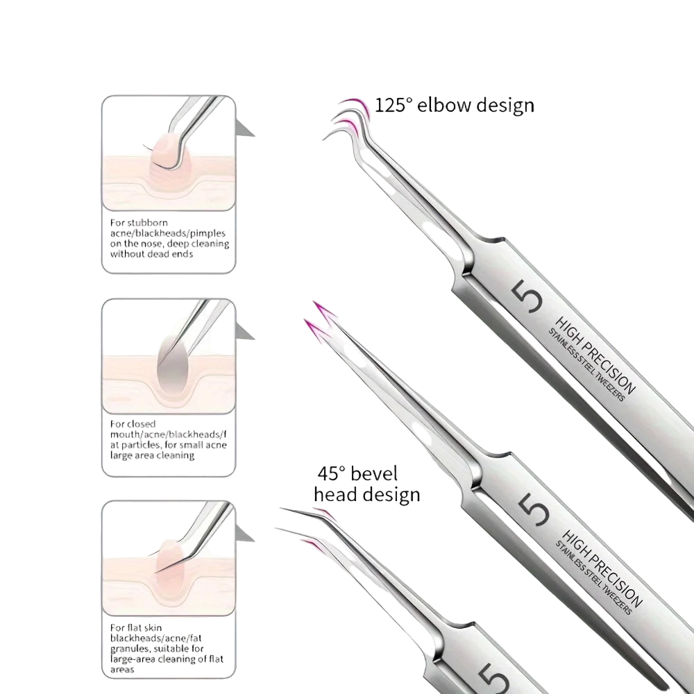8-Piece Stainless Steel Blackhead & Pimple Removal Kit