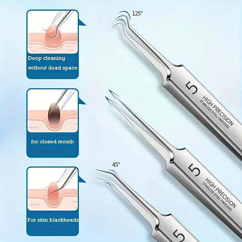 8-Piece Stainless Steel Blackhead & Pimple Removal Kit